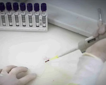 Paciente em SP com suspeita de ebola testa positivo para meningite