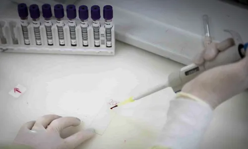 Paciente em SP com suspeita de ebola testa positivo para meningite