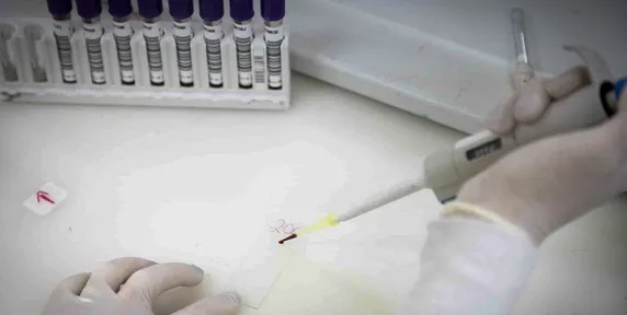 Paciente em SP com suspeita de ebola testa positivo para meningite
